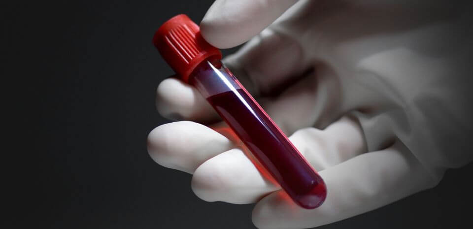 Detecting Vitamin Deficiency Through Blood Tests.